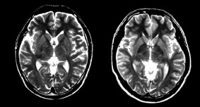 加藤俊徳の「リーダー脳のつくり方」ＣＤ